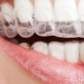 Everything You Need to Know About Teeth Whitening Strips