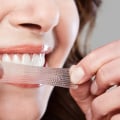 Do Teeth Whitening Strips Expire? An Expert's Guide