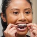 The Best Teeth Whitening Strips for a Brighter Smile