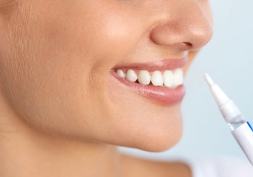 Which Teeth Whitening is Best? A Comprehensive Guide