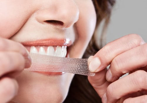 Are Teeth Whitening Strips Safe for Your Teeth?