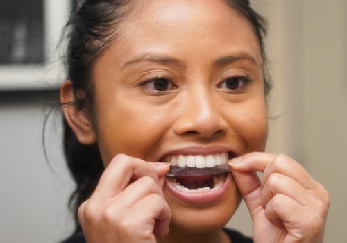 Which Teeth Whitening Strips Work the Fastest?